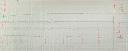 Lot #8041 John Glenn Friendship 7 Launch EKG Readout - Image 2