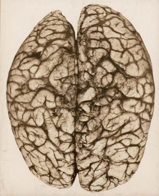 Lot #255 Harvey Cushing Typed Letter Signed to a Noted California Pathologist - Image 2