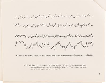Lot #8114 Project Gemini Heart and Respiratory Medical Data Archive - From the Collection of an Electrophysiologist at McDonnell Aircraft - Image 6